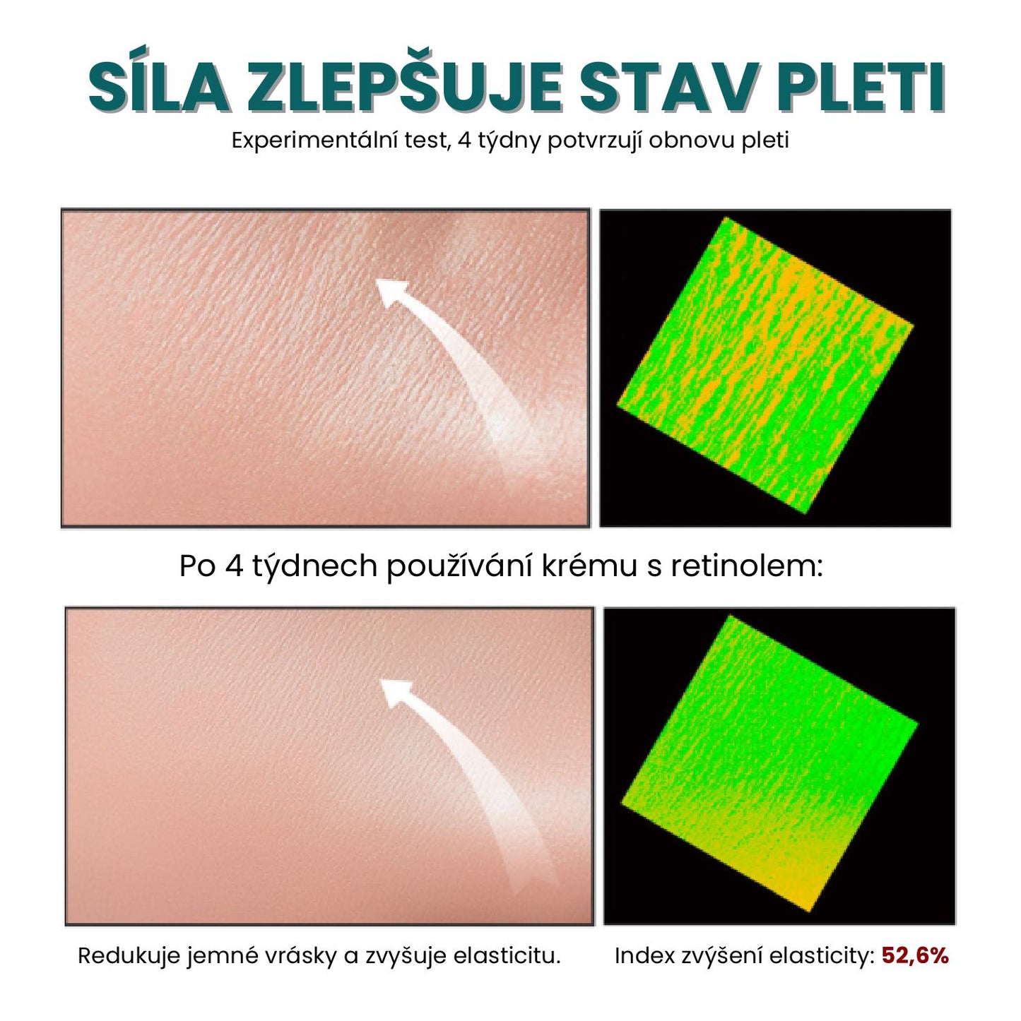Sada protistárnoucích opalovacích filtrů, bělící krém s retinolem ✨