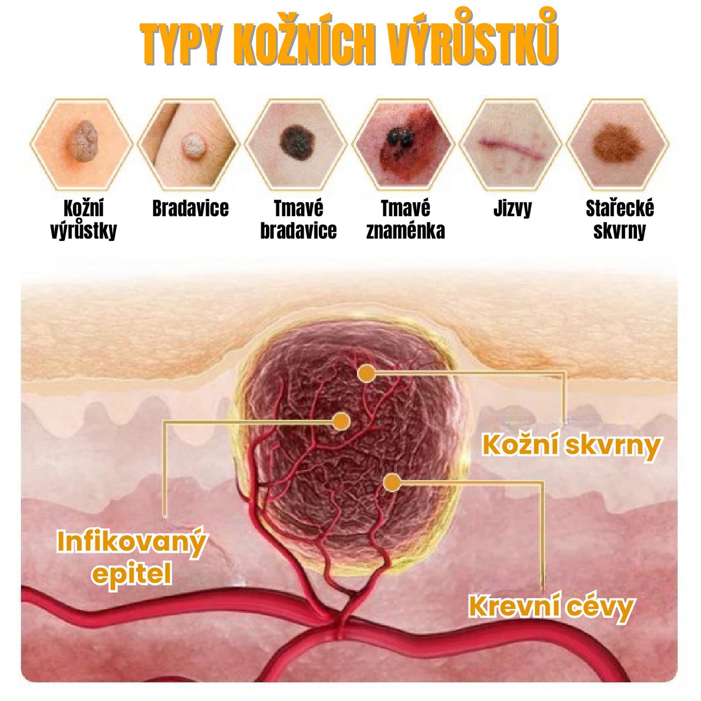 Přírodní Regenerační Krém S Včelím Jedem Pro Bezpečné Odstranění Bradavic Pro Všechny Typy Pleti.