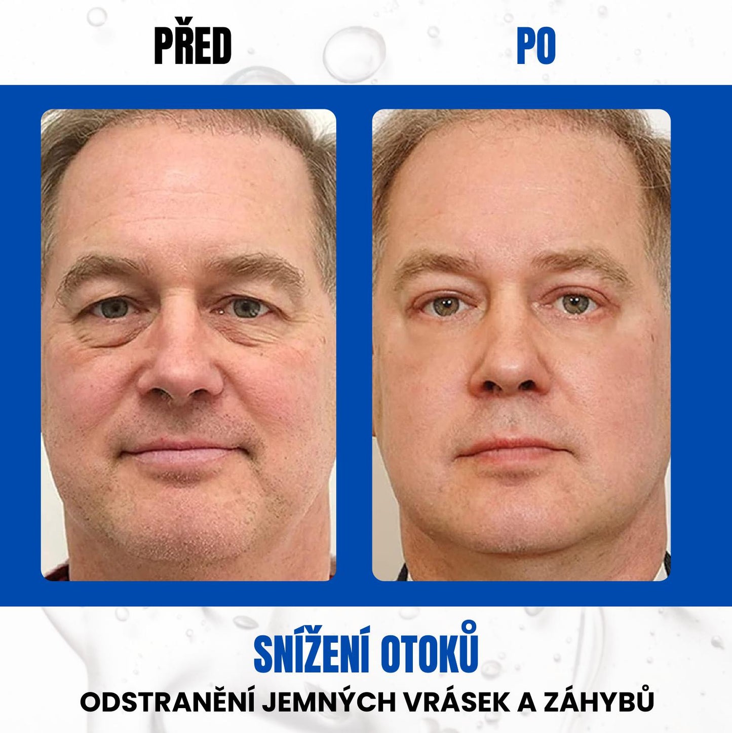 Krém Proti Tmavým Kruhům Pod Očima S Anti-aging Retinolem