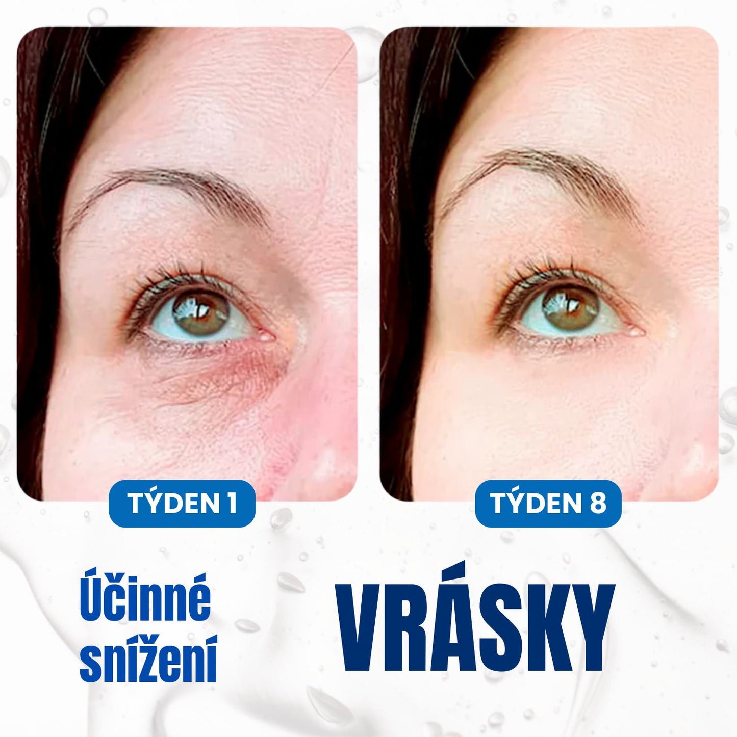 Krém Proti Tmavým Kruhům Pod Očima S Anti-aging Retinolem