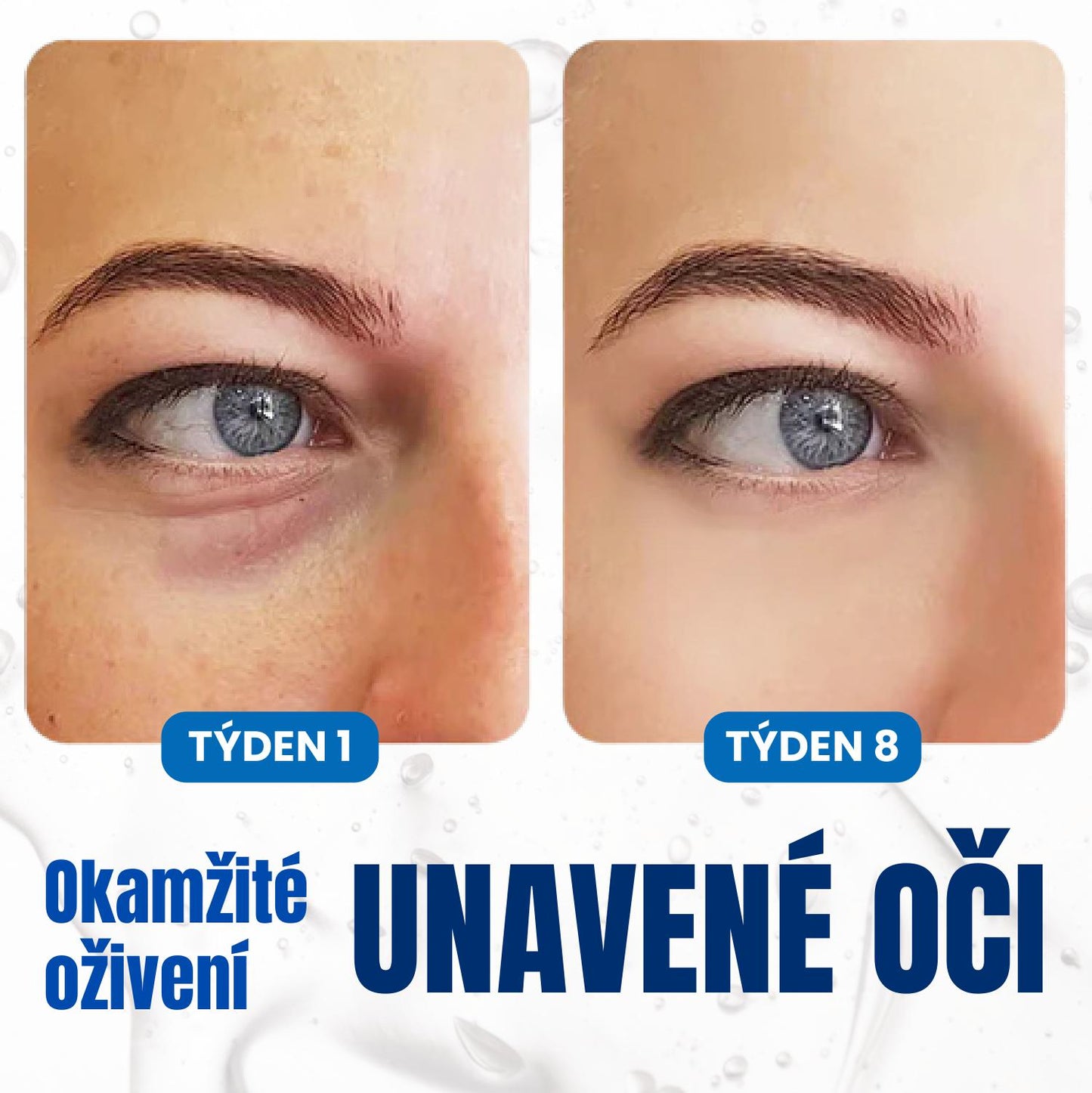 Krém Proti Tmavým Kruhům Pod Očima S Anti-aging Retinolem