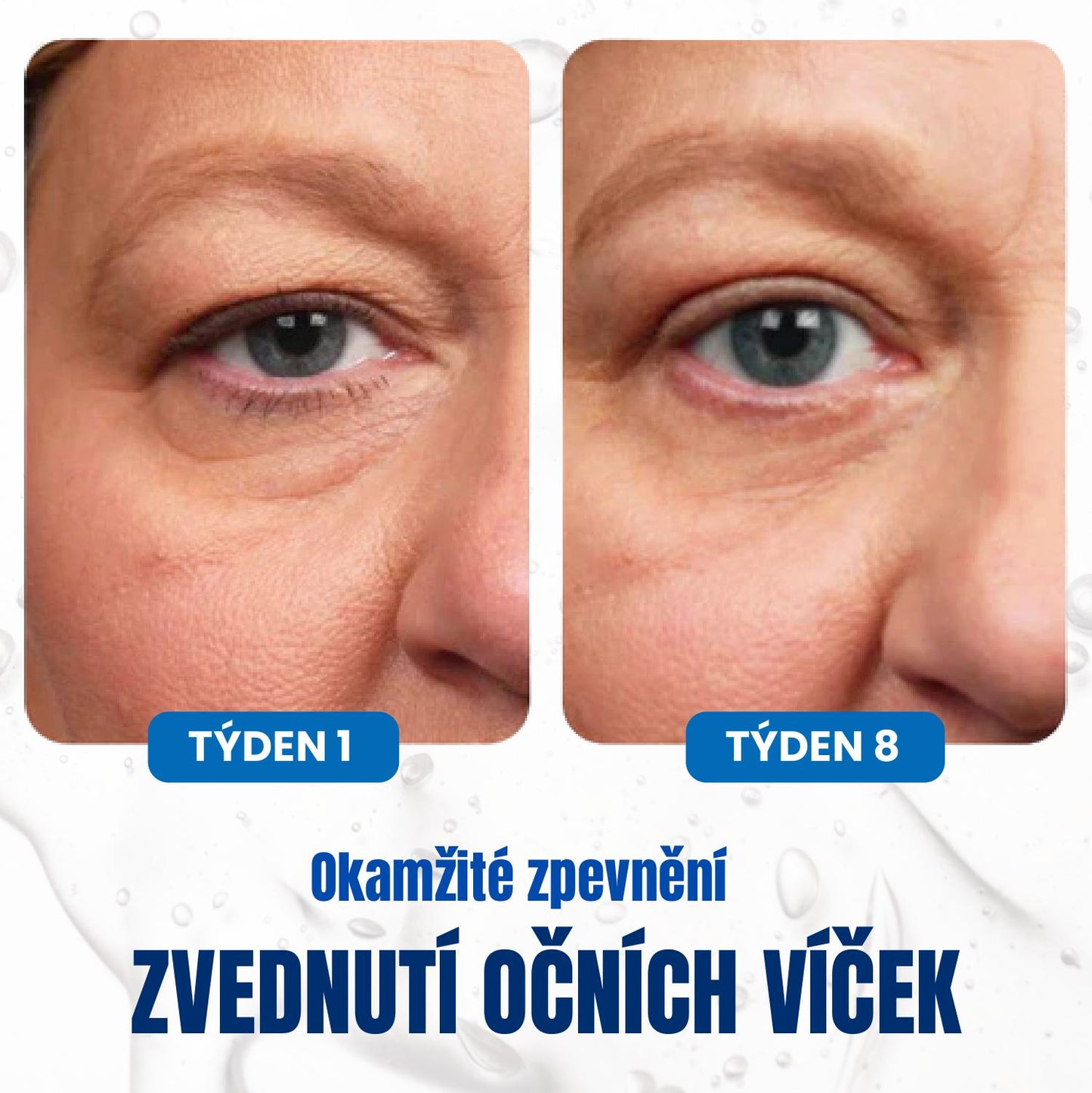 Krém Proti Tmavým Kruhům Pod Očima S Anti-aging Retinolem