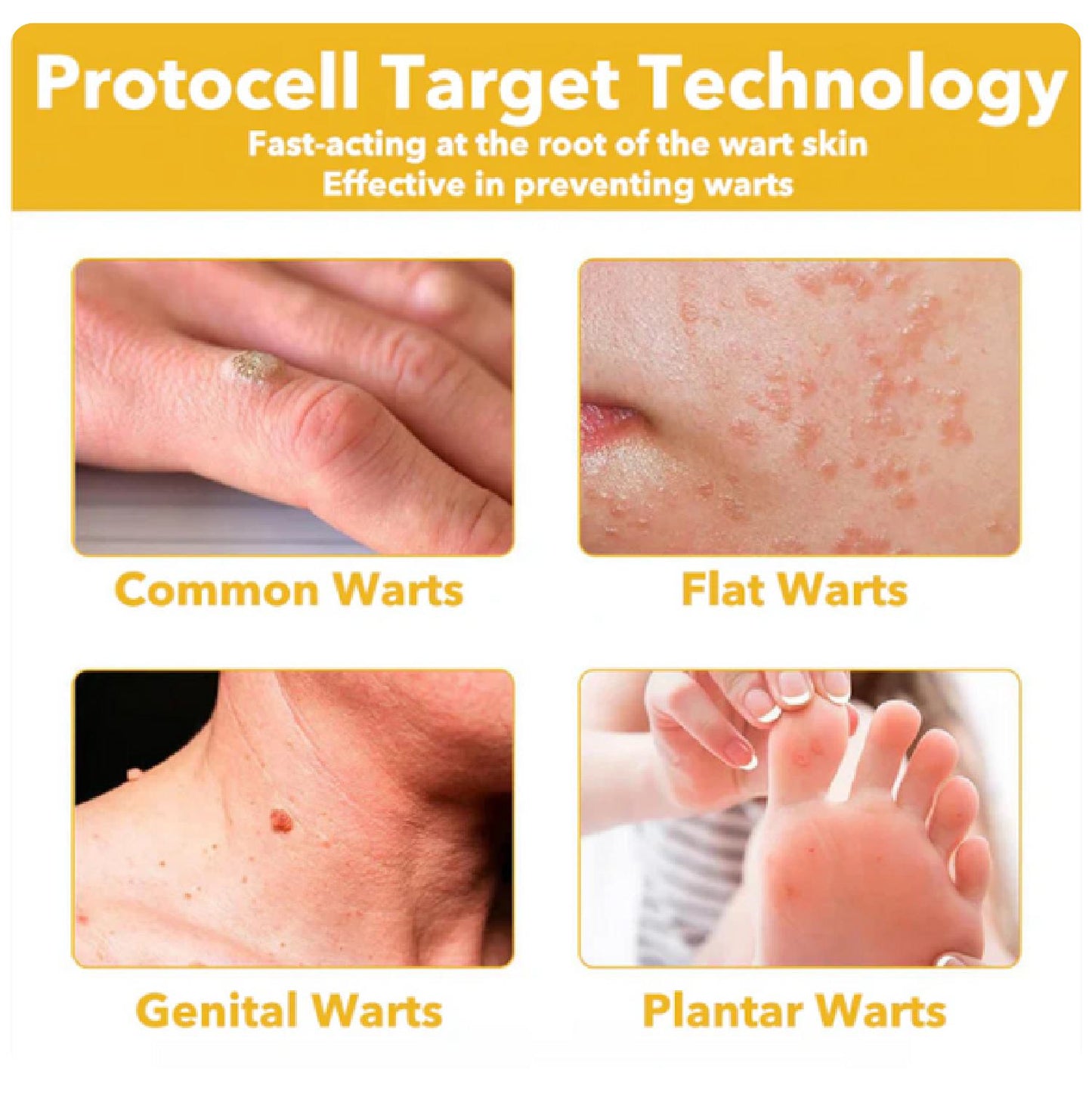 Přírodní Regenerační Krém S Včelím Jedem Pro Bezpečné Odstranění Bradavic Pro Všechny Typy Pleti