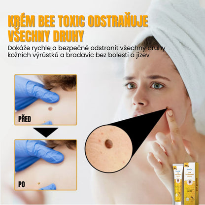 Přírodní Regenerační Krém S Včelím Jedem Pro Bezpečné Odstranění Bradavic Pro Všechny Typy Pleti.