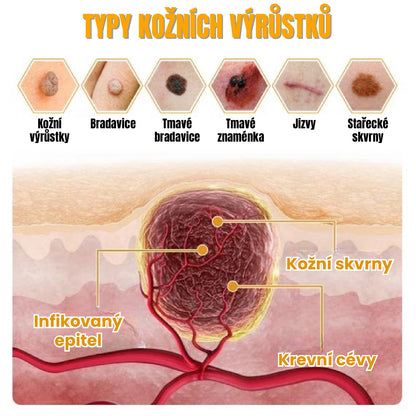 Přírodní Regenerační Krém S Včelím Jedem Pro Bezpečné Odstranění Bradavic Pro Všechny Typy Pleti.